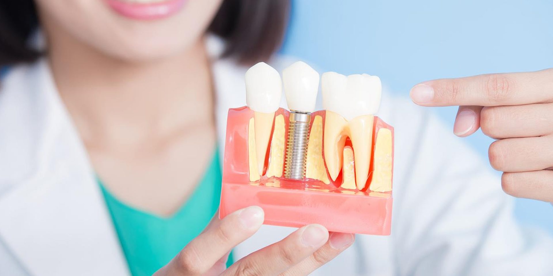 implant-310320-1920x960